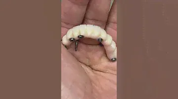 Zirconia Bridge with minimum Pink Porcelain