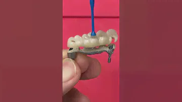 4-Unit Bridge Implant