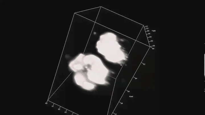 ZEISS ELYRA: 3D superresolution imaging of Chinese Hamster Ovary (CHO) cells