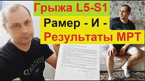 Грыжа L5S1 - Симптомы - Размер - Результаты МРТ, есть ли резорбция